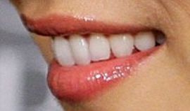 Picture of Jessica Gomes teeth and smile