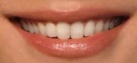 Picture of Jessica Gomes teeth and smile