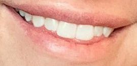 Jessica Simpson's teeth