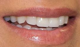 Picture of Jillian Michaels teeth and smile