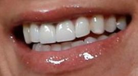 Picture of Jillian Michaels teeth and smile