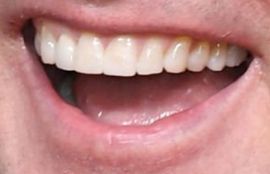 Picture of Jim Carrey teeth and smile