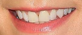 Picture of Joanne Froggatt teeth and smile