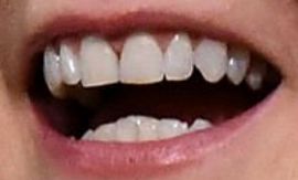 Picture of Joanne Froggatt teeth and smile