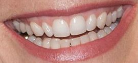Picture of Jodie Foster teeth and smile