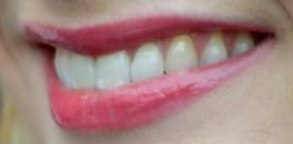 Picture of Jodie Whittaker healthy teeth and smile