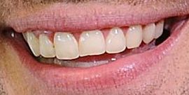 Picture of John Krasinski teeth and smile