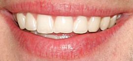 Picture of John Krasinski teeth and smile