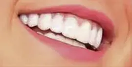 Picture of JoJo Siwa teeth and smile