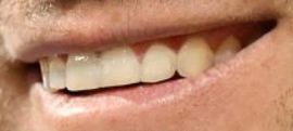 Picture of Jordan Spieth teeth and smile