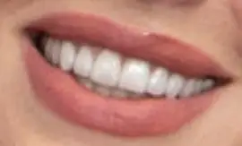 Picture of Julia Fox teeth and smile