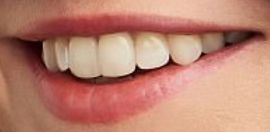 Picture of Julia Stiles teeth and smile