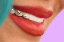 Picture of Karol G teeth and smile
