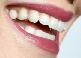 Picture of Kate Bosworth teeth and smile