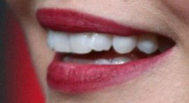 Picture of Kate Bosworth teeth and smile