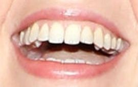 Picture of Kate McKinnon teeth and smile