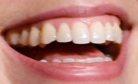 Picture of Kate McKinnon teeth smile