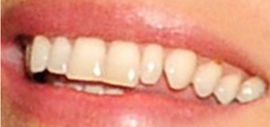 Picture of Kate Moss teeth and smile