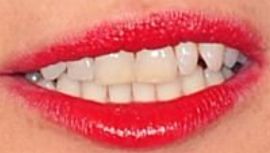 Picture of Kate Moss teeth and smile