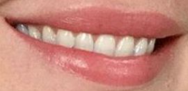 Picture of Katherine Heigl teeth and smile
