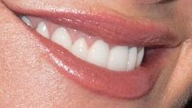 Picture of Kathy Ireland teeth and smile