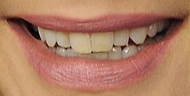Katie Holmes teeth and smile