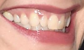 Katie Holmes teeth and smile