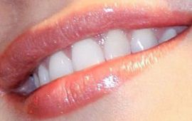 Picture of Katrina Kaif healthy teeth and smile