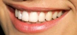 Picture of Kelly Brook teeth and smile