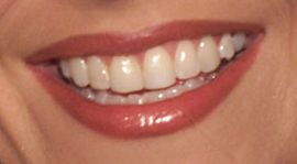 Kelly Ripa's teeth