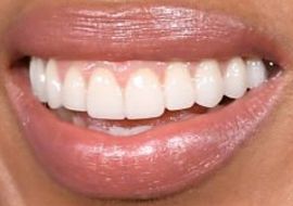Picture of Kerry Washington teeth and smile