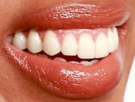Picture of Kerry Washington teeth and smile