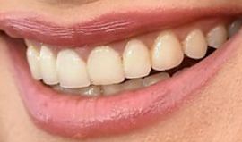Picture of Kristen Bell teeth and smile