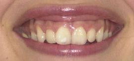 Picture of Laetitia Casta teeth and smile