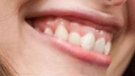 Picture of Laetitia Casta teeth and smile