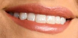 Picture of Lainey Wilson's healthy teeth and winning smile