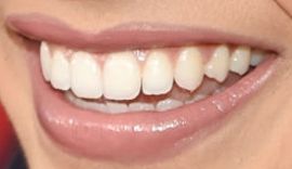 Picture of Leslie Grace teeth and smile