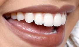 Picture of Leslie Grace teeth smile