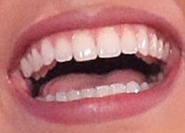 Picture of Leslie Grace teeth and smile