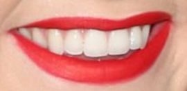 Picture of Lindsay Arnold teeth and smile