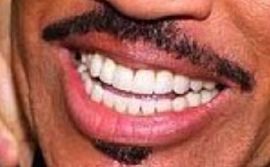 Picture of Lionel Richie teeth and smile