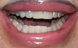 Picture of Lisa Rinna teeth and smile