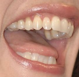 Picture of Liv Tyler teeth and smile