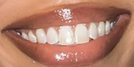 Picture of Lori Harvey teeth and smile