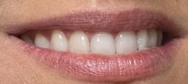 Picture of Luisana Lopilato teeth and smile