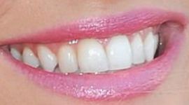 Picture of Luisana Lopilato teeth and smile