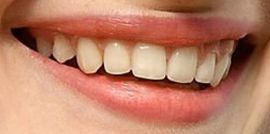 Picture of Mackenzie Foy teeth and smile