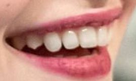 Picture of Mackenzie Foy teeth and smile