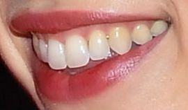 Picture of Margaret Qualley teeth and smile