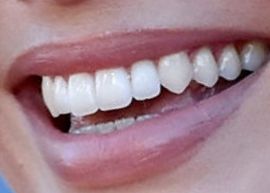 Margot Robbie's teeth